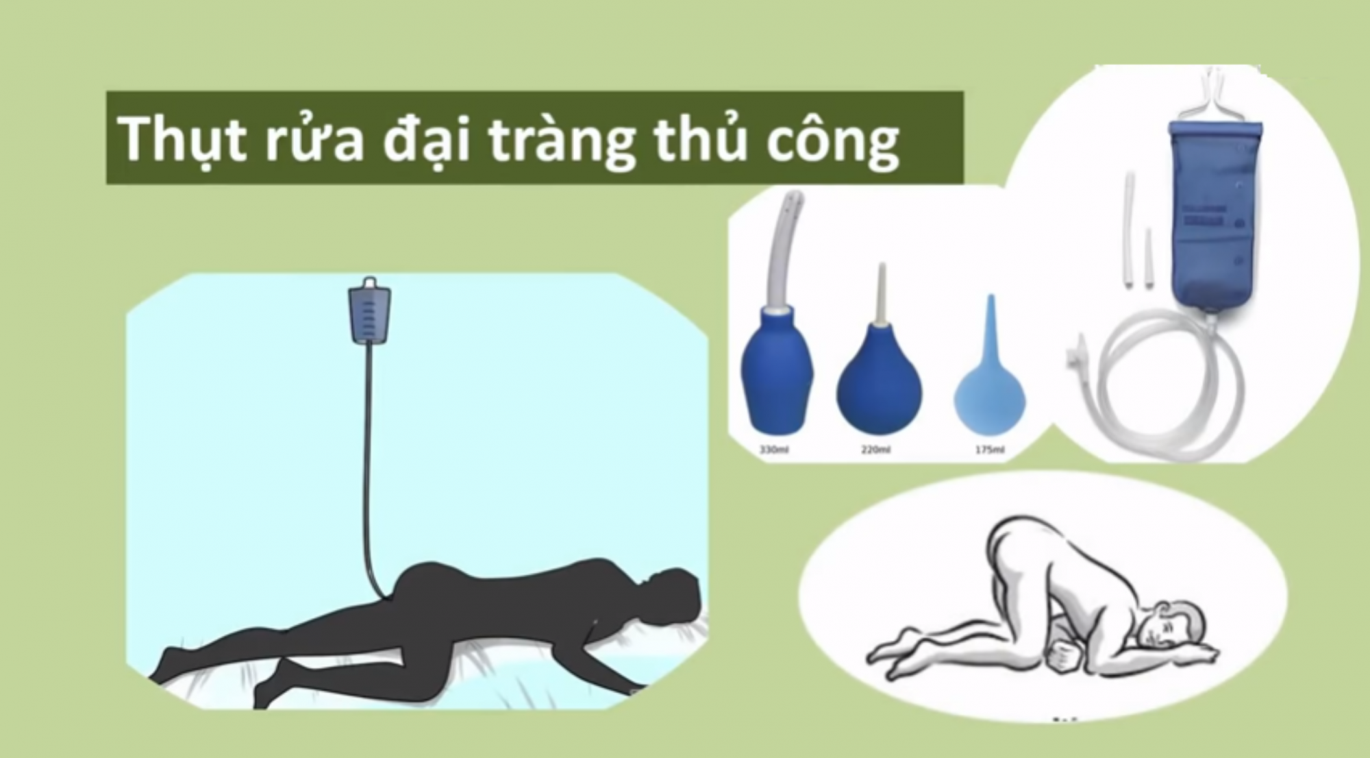 Hướng dẫn tháo  thụt đại tràng